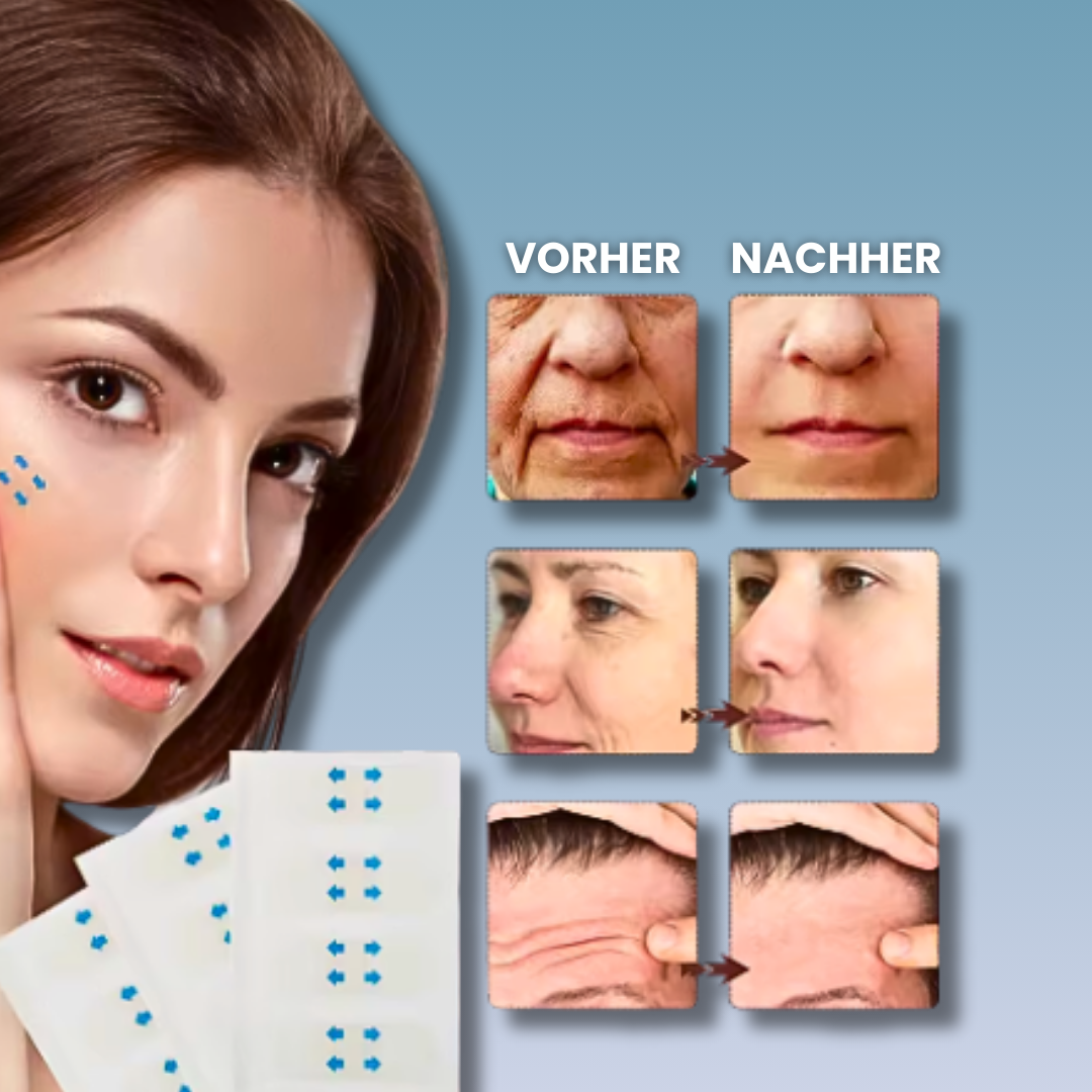 FaceLift